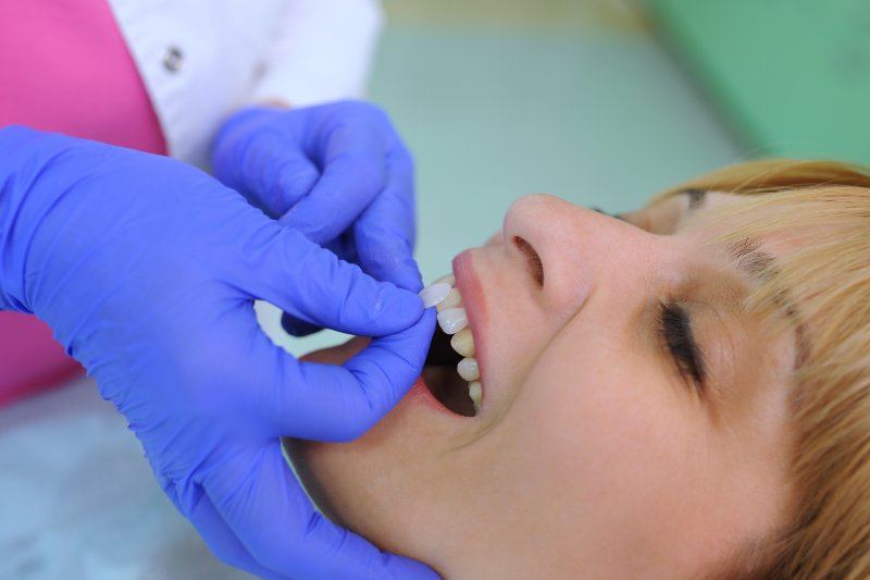 Toothbar photograph