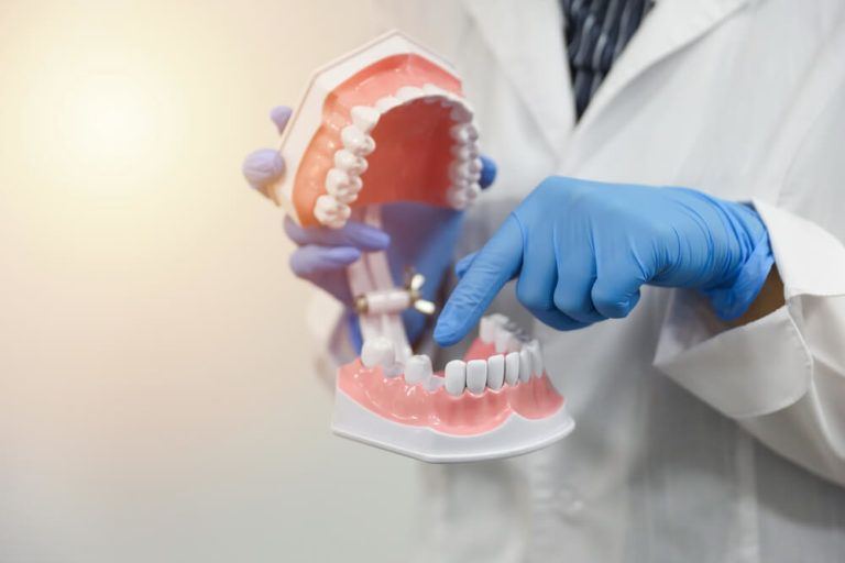 Holding model of mouth with missing teeth