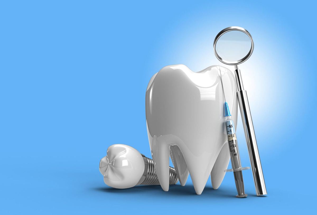 Various dental implant materials displayed against a blue background, illustrating the components used in implant dentistry.