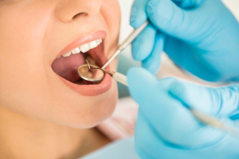 Holding open mouth for dental exam