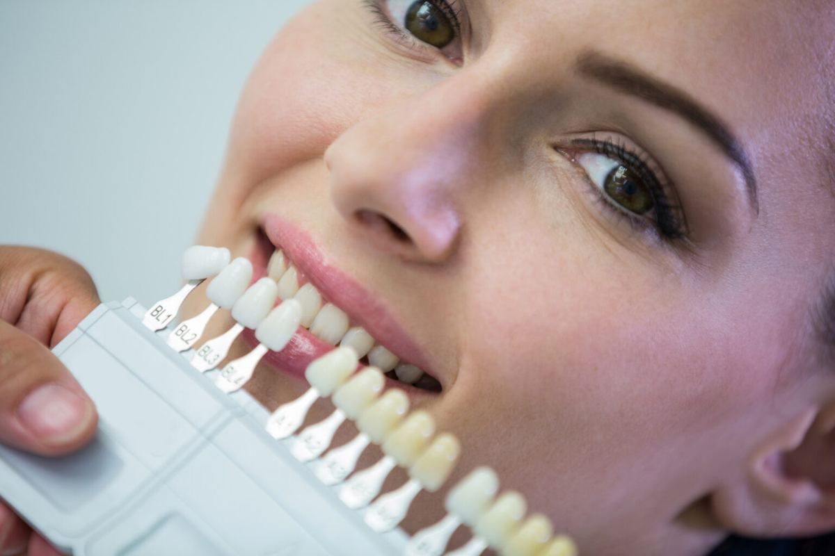 Dentist comparing veneer shades against a patient's teeth to ensure a perfect match, highlighting personalized dental aesthetics.