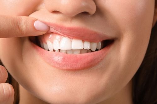 Pulling up lip to show teeth